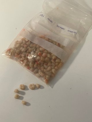 Dientes acrílicos para prótesis dentales