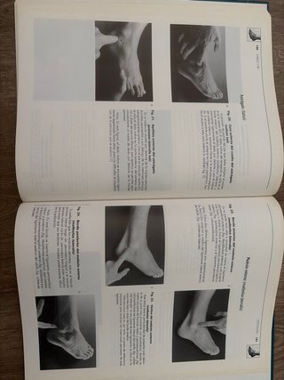 Atlas de Anatomía Palpatoria de la Extremidad I...