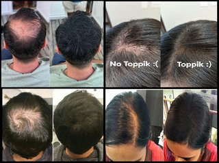3x Toppik Fibras Capilares Negro