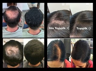 3x Toppik Fibras Capilares Marrón Oscuro