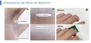 Máquina Láser 2 en 1