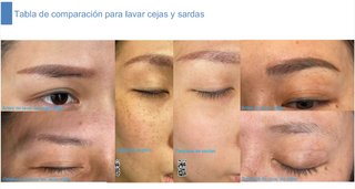 Máquina Láser 2 en 1