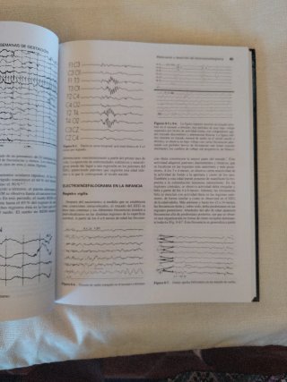 MANUAL DE ELECTROENCEFALOGRAFIA