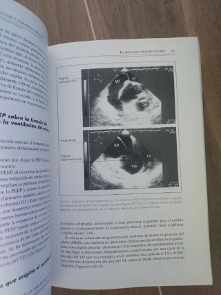 Ventilación mecánica en anestesia y cuidados c...