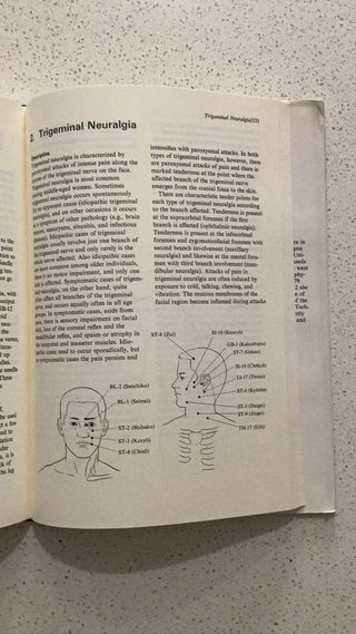 Clinical Acupuncture: A Practical Japanese Appr...