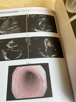 Manual CTO de desgloses MIR : 2010-2022