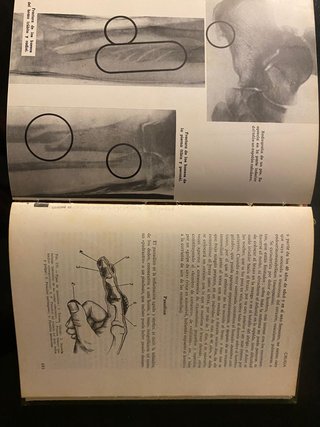 Medicina para todos. 1975.