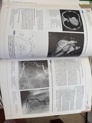 Radiología anatómica