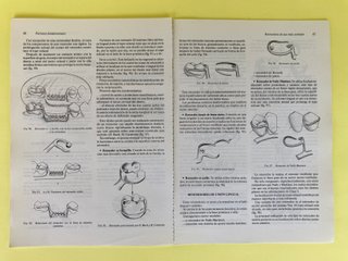 Manual de prótesis parcial removible