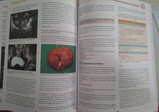 Pack 2 manuales CTO: Neumología y Urología. Nuevos