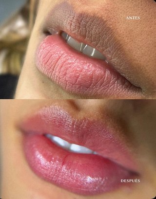 Micropigmentacion de Labios