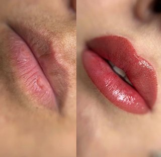 Promo en Micropigmentación 2x1