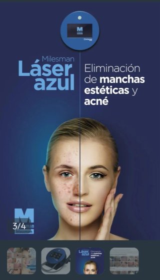 Alquiler Láser Azul Milesman Blauman