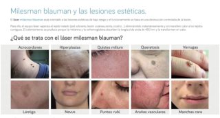 Alquiler Láser Azul Milesman Blauman