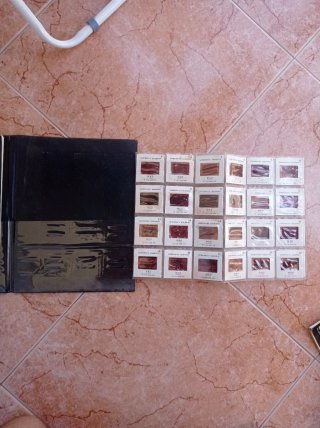 Revista antigua Patofisiología cardiaca