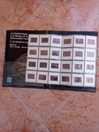 Revista antigua Patofisiología cardiaca
