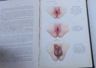 Tratado Enciclopédico de Pediatría
