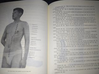 Localización Manual de Los Puntos de Acupuntura...