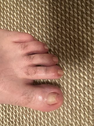 Ofrezo servicio de pedicura clínca