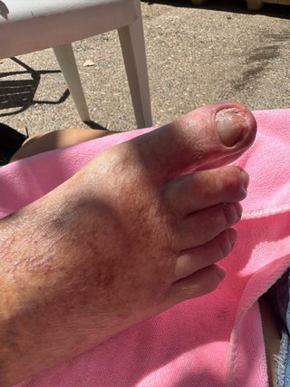 Ofrezo servicio de pedicura clínca