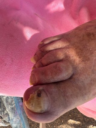 Ofrezo servicio de pedicura clínca