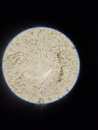 Set Microscopio Ixplo 100x-1200x