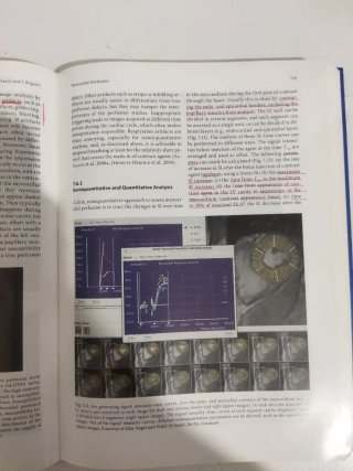 Clinical Cardiac MRI