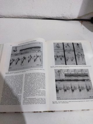 Libro Echocardiography de Harvey Feigenbaum