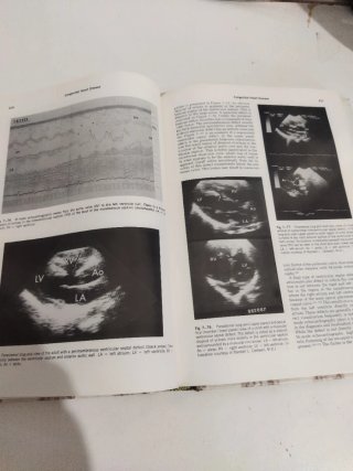 Libro Echocardiography de Harvey Feigenbaum