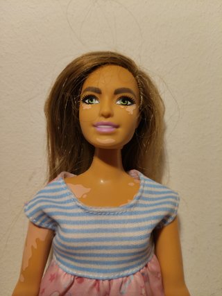 Barbie. Ref Vitiligo. Curvy