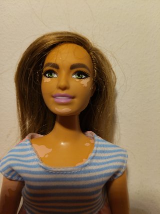 Barbie. Ref Vitiligo. Curvy