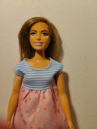 Barbie. Ref Vitiligo. Curvy