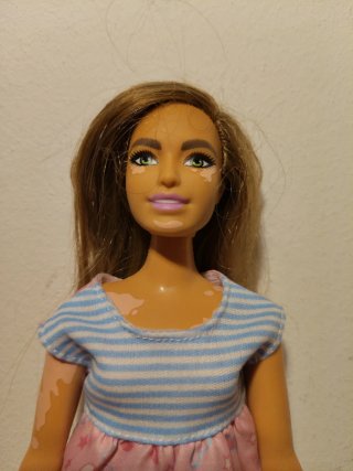 Barbie. Ref Vitiligo. Curvy