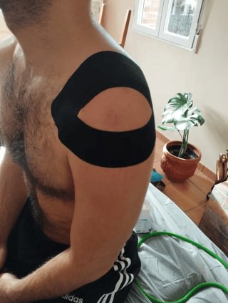 Fisioterapia a domicilio