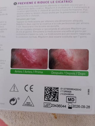 Mepiform reduce cicatrices.  Cad 28- 9-2026