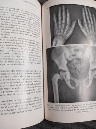 Libro Medicina Nefrourologia Infantil 1970