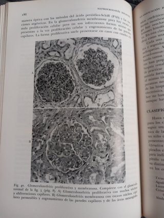 Libro Medicina Nefrourologia Infantil 1970