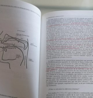 Como hacer hablar al niño con síndrome de down ...