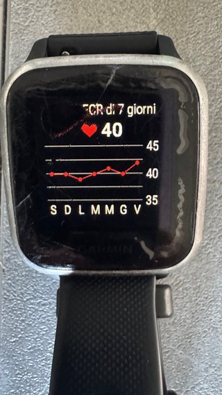 Garmin Venu Sq Music – Funzionante – Da sistemare