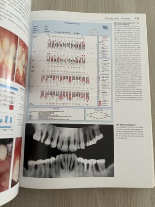 Atlanti di odontostomatologia . Parodontologia
