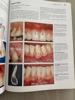 Atlanti di odontostomatologia . Parodontologia