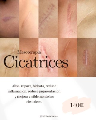 Eliminación cicatrices
