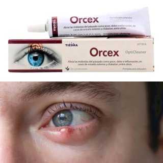 Orcex Crema cuidado del párpado 15 g