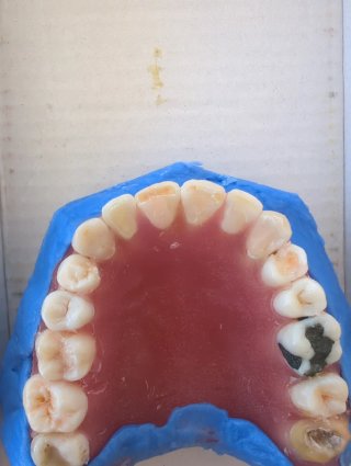 Tipodonto Dientes Naturales