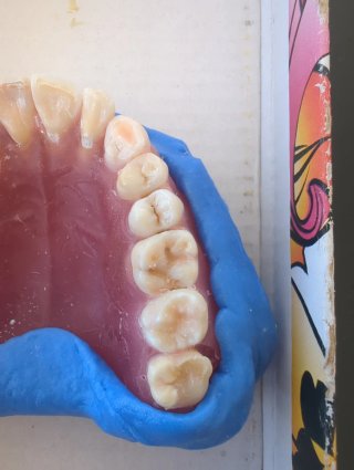 Tipodonto Dientes Naturales