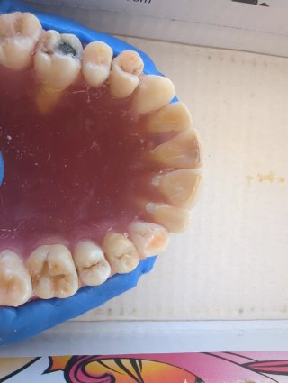 Tipodonto Dientes Naturales