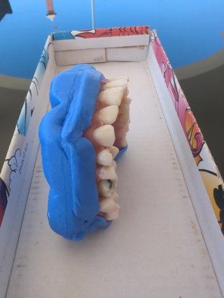 Tipodonto Dientes Naturales