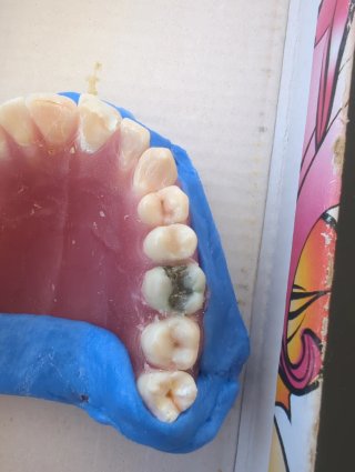 Tipodonto Dientes Naturales
