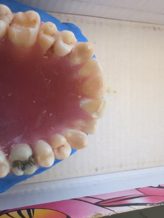 Tipodonto Dientes Naturales