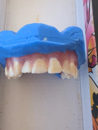 Tipodonto Dientes Naturales